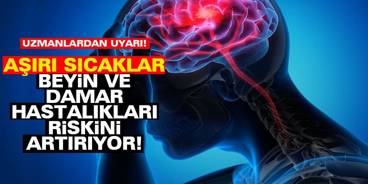 Uzmanlardan uyarı! Aşırı sıcaklar beyin ve damar hastalıkları riskini artırıyor