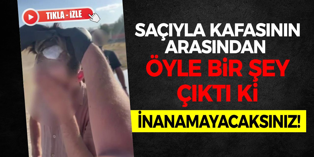 Saçıyla Kafasının Arasından Öyle Bir Şey Çıktı Ki! İnanamayacaksınız!