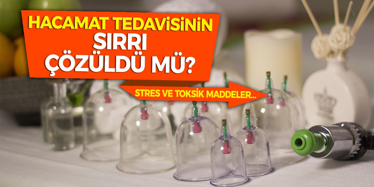 Hacamat Tedavisinin Sırrı Çözüldü Mü? Stres ve Toksik Maddeler…