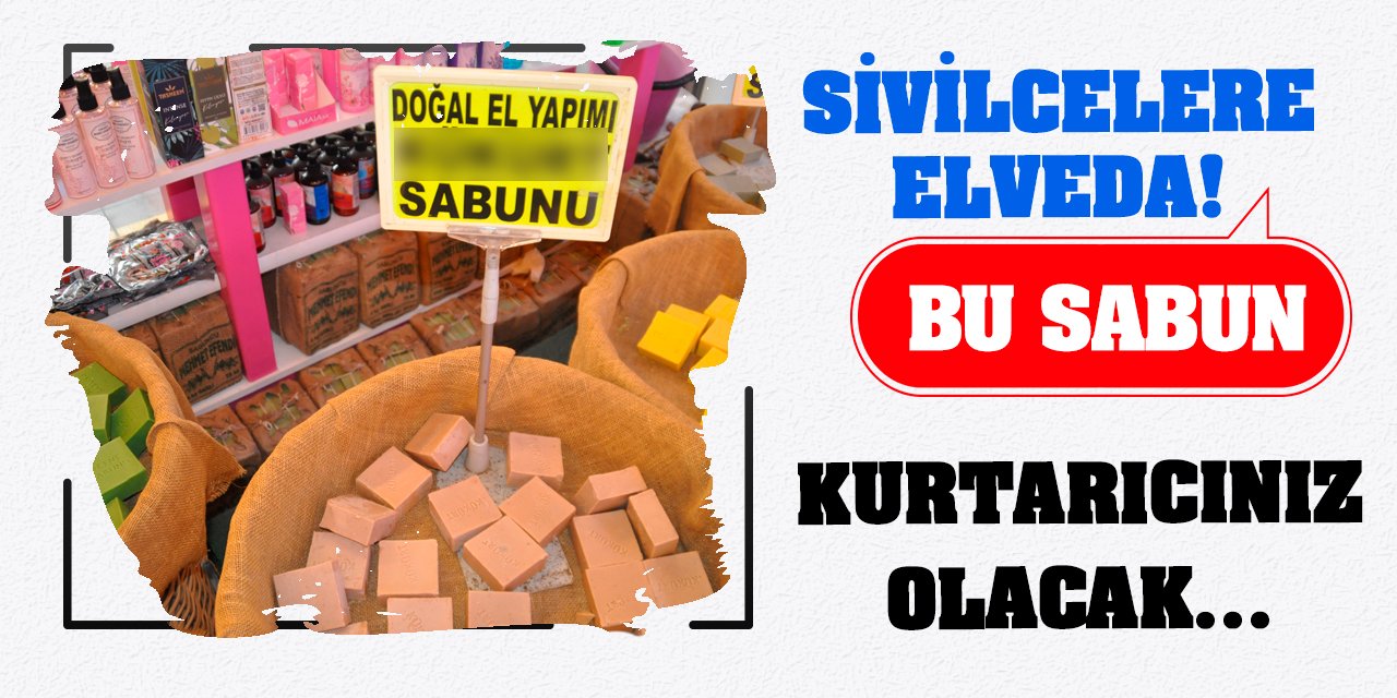 Sivilcelere Elveda! Bu Sabun Kurtarıcınız Olacak…