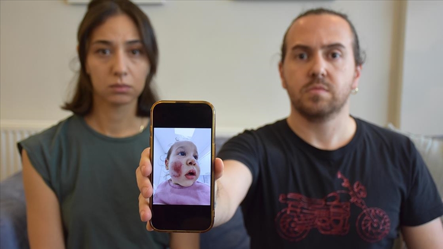 Kreş Skandalı! Aile Şikayetçi Oldu