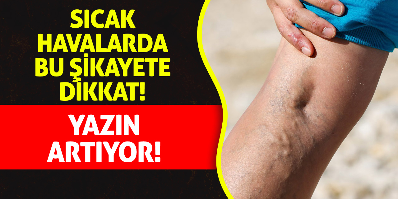 Sıcak Havalarda Bu Şikayete Dikkat! Yazın Artıyor