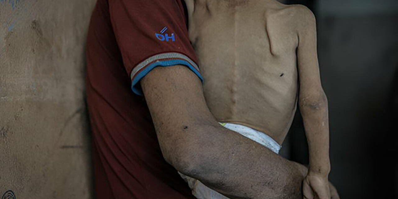 Gazze'de açlıktan ölenlerin sayısı 269'a çıktı