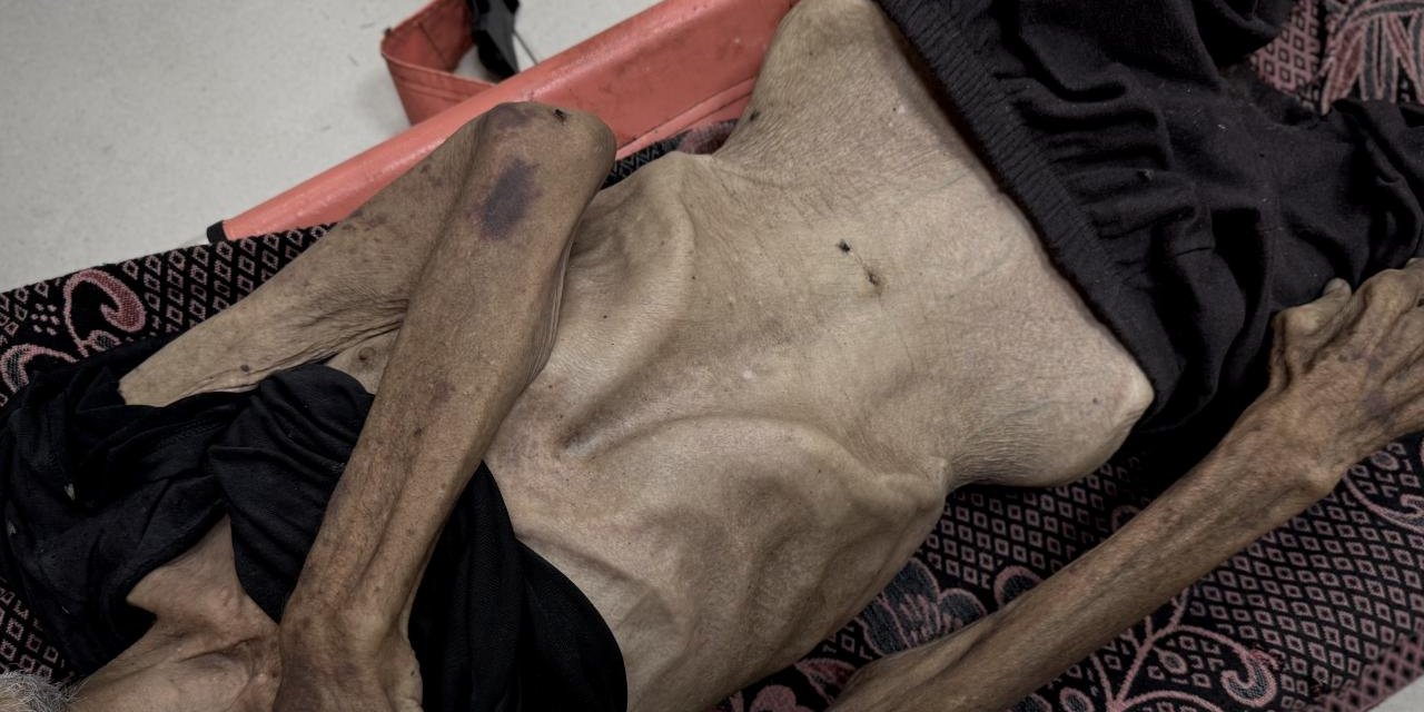 Gazze'de son 24 saatte 5 kişi daha açlıktan hayatını kaybetti