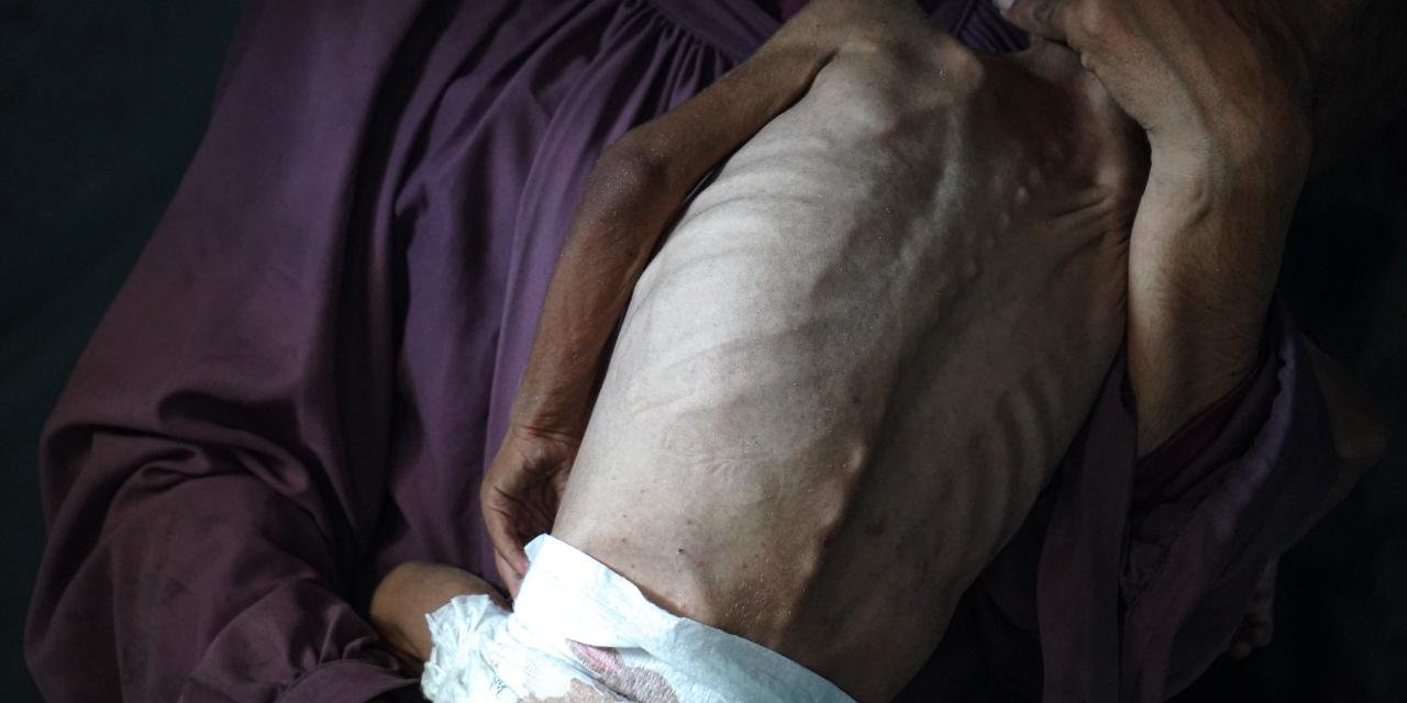 Gazze'de son 24 saatte 3 kişi daha açlıktan hayatını kaybetti