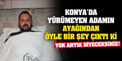 Konya’da yürümeyen adamın ayağından öyle bir şey çıktı ki… Yok artık diyeceksiniz!