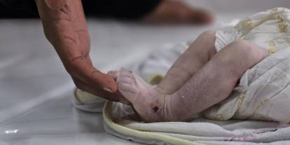 Gazze'de bir bebek daha açlıktan can verdi