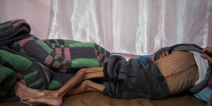 Gazze'de son 24 saatte 4 Filistinli daha açlıktan hayatını kaybetti