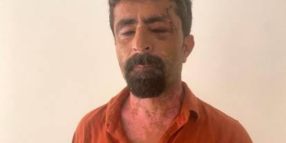 Kan Donduran Olay! Kayınpeder Hastanede, Damat Gözaltında!