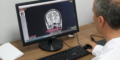 'Her unutkanlık Alzheimer hastalığı değildir'