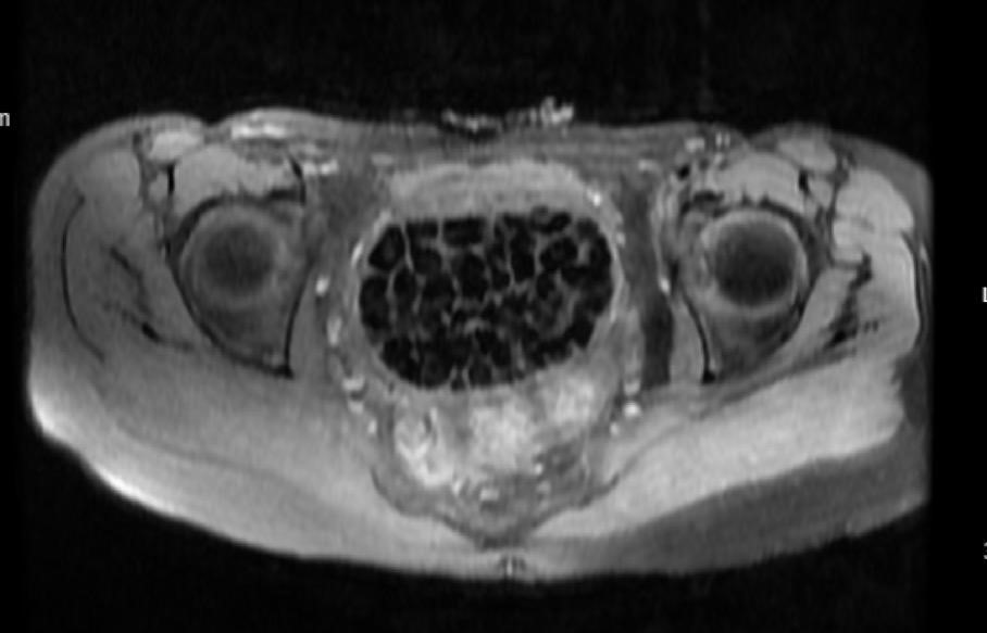 aw542492-08-002.jpg